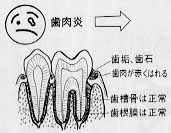 歯の健康　口の健康